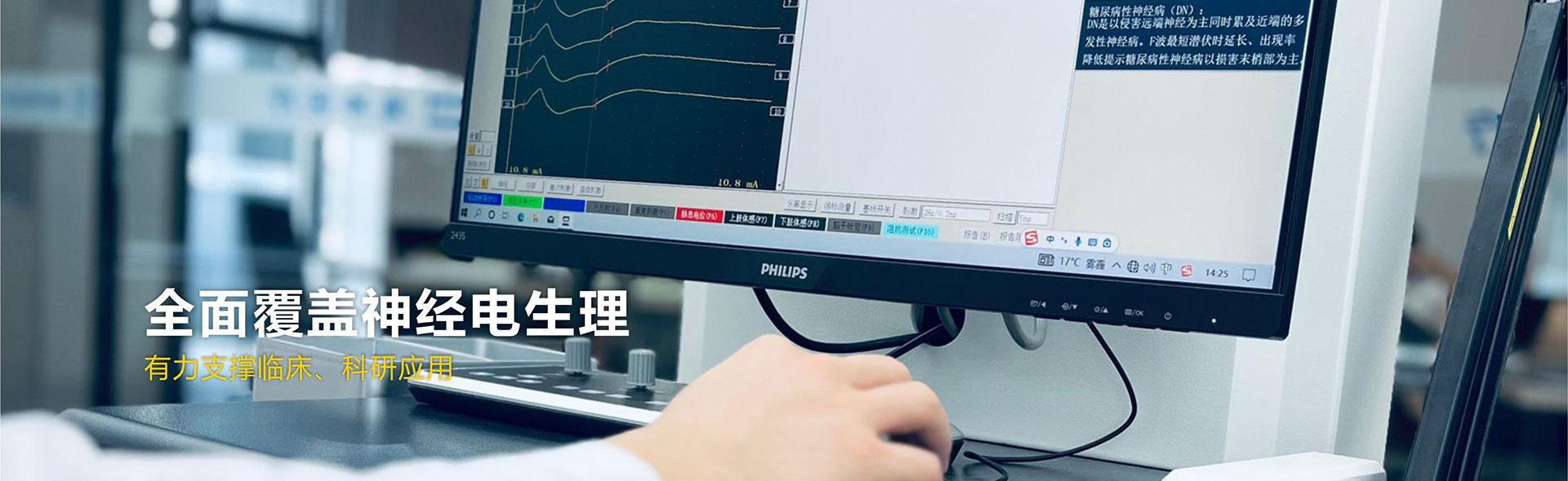 超声