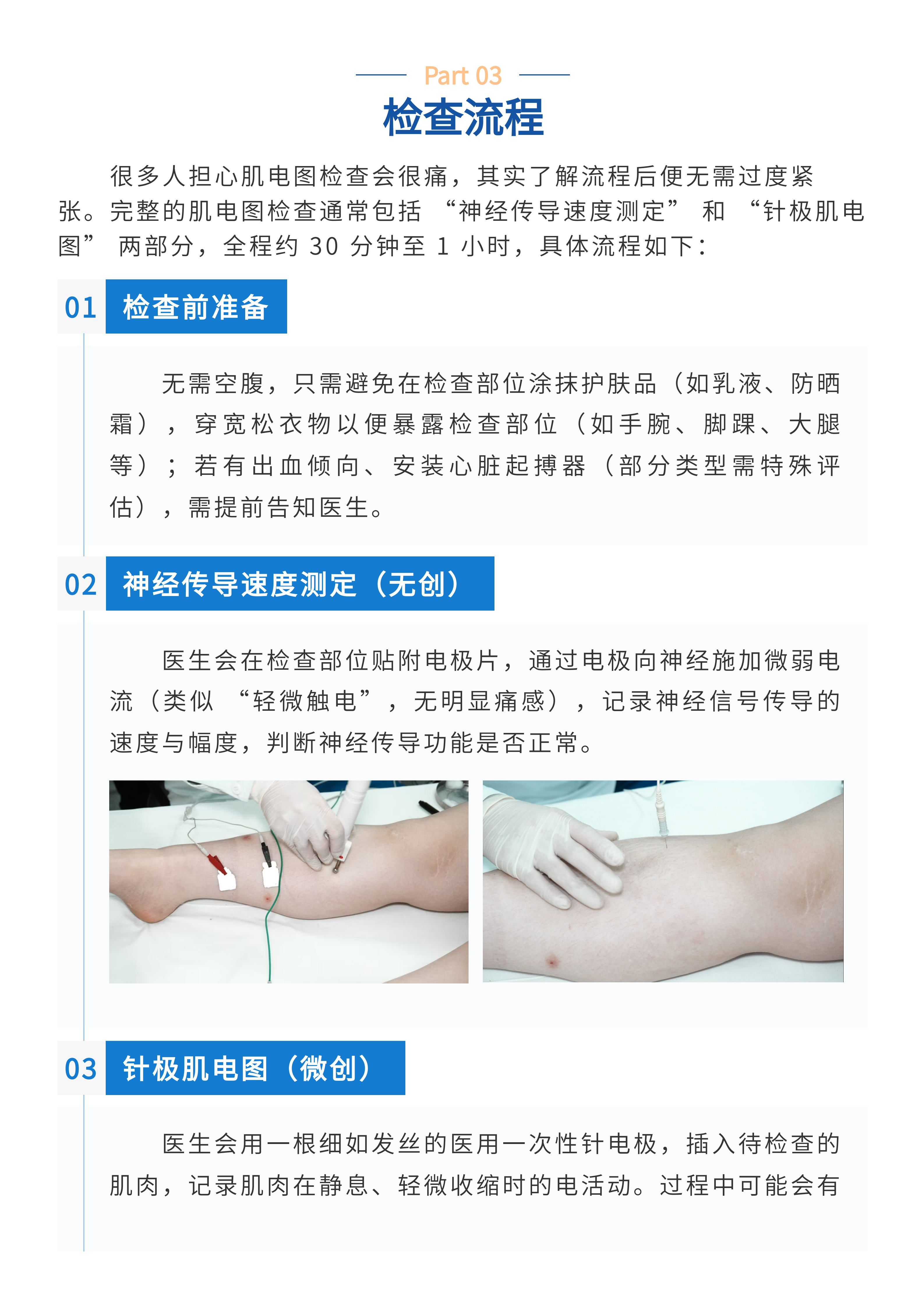 【科普】肌电图检查：神经肌肉健康的“侦察兵”，海神医疗为临床鉴别诊断赋能