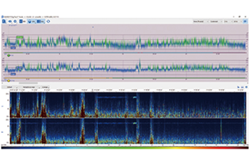 多导脑电地形图仪