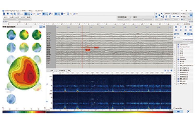 多导脑电地形图仪