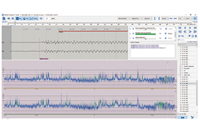 多导脑电地形图仪